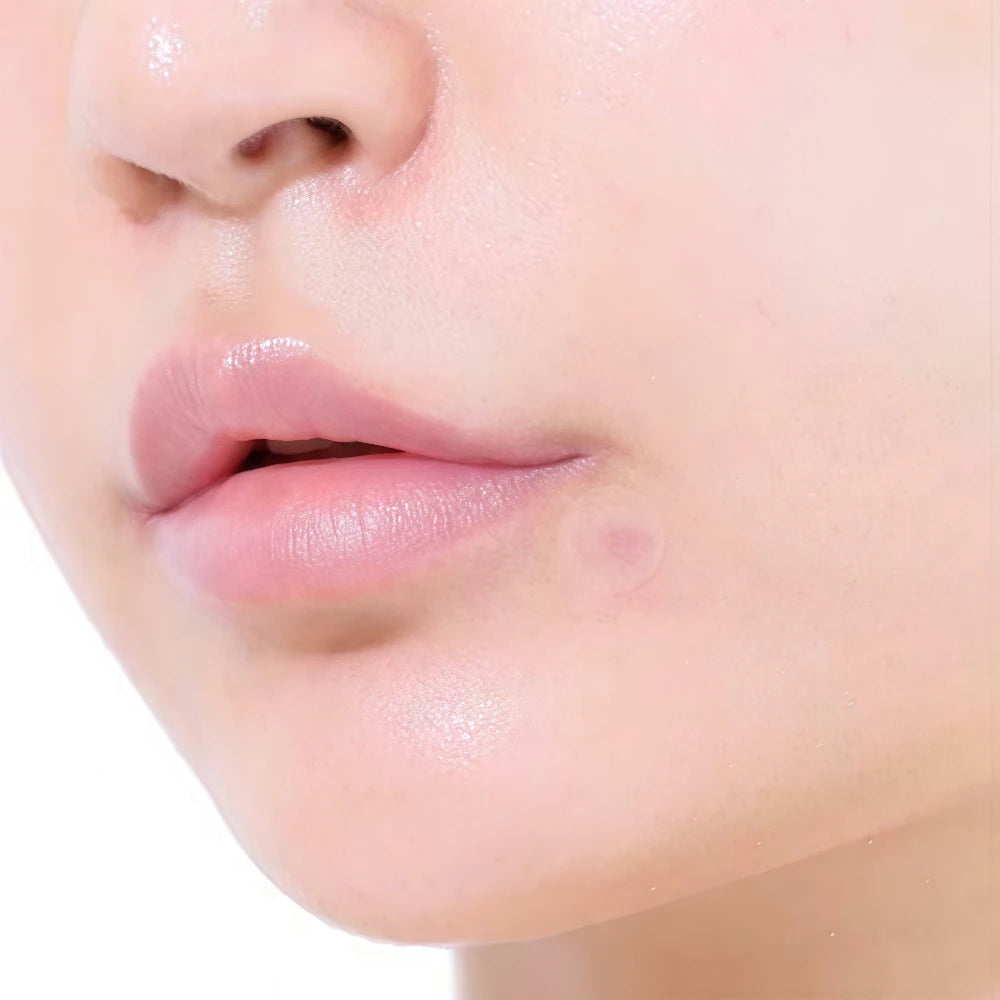 OLIVE YOUNG Care Plus Spot Cover Patch Calming