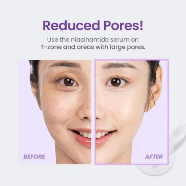 TIRTIR Niacinamide 20% Serum 30ml